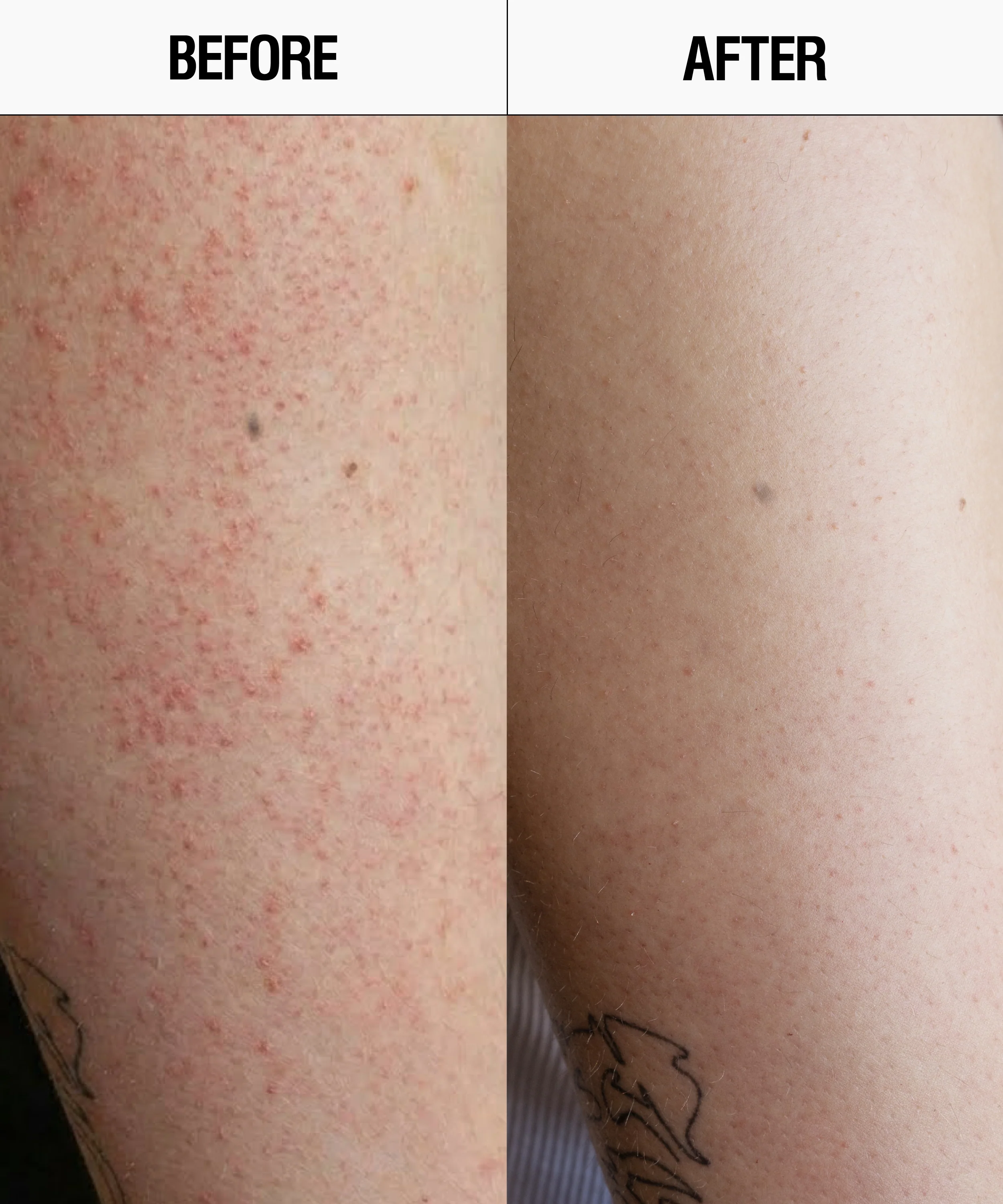 Resurfacing Body Cleanser - 50mL - Image 3